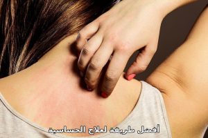 أفضل طريقة لعلاج الحساسية